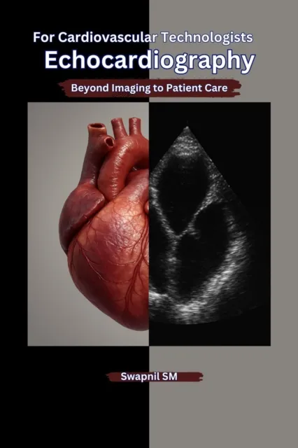 Echocardiography for Cardiovascular Technologists