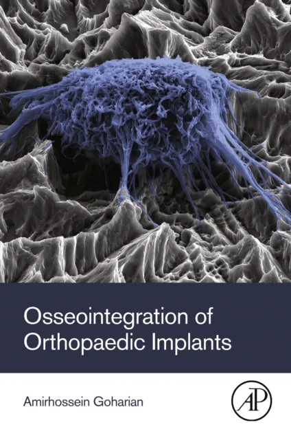 Osseointegration of Orthopaedic Implants