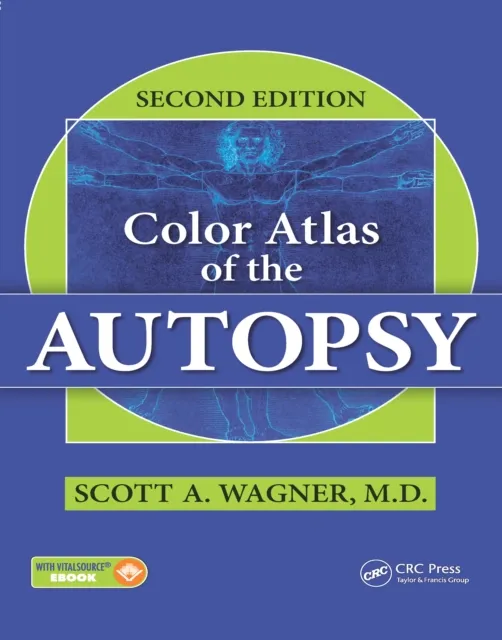 Color Atlas of the Autopsy
