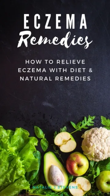 Eczema Remedies | How to Relieve Eczema With Diet & Natural Remedies