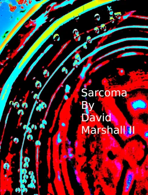Sarcoma