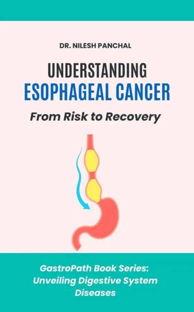 Understanding Esophageal Cancer: From Risk to Recovery