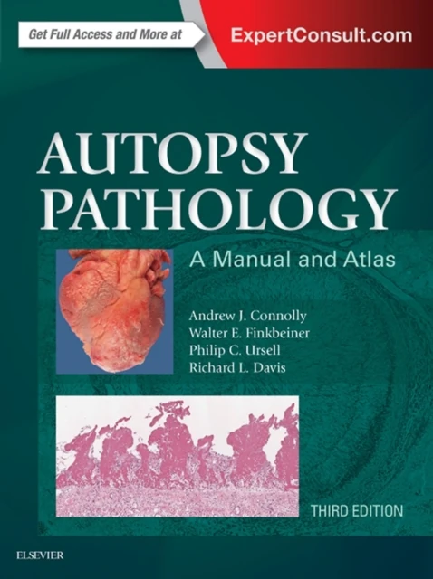 Autopsy Pathology: A Manual and Atlas E-Book