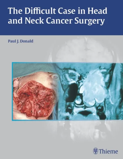 Difficult Case in Head and Neck Cancer Surgery