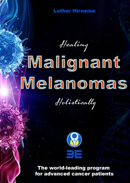 Malignant Melanomas
