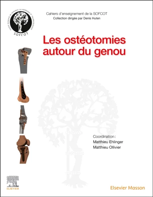 Les osteotomies autour du genou