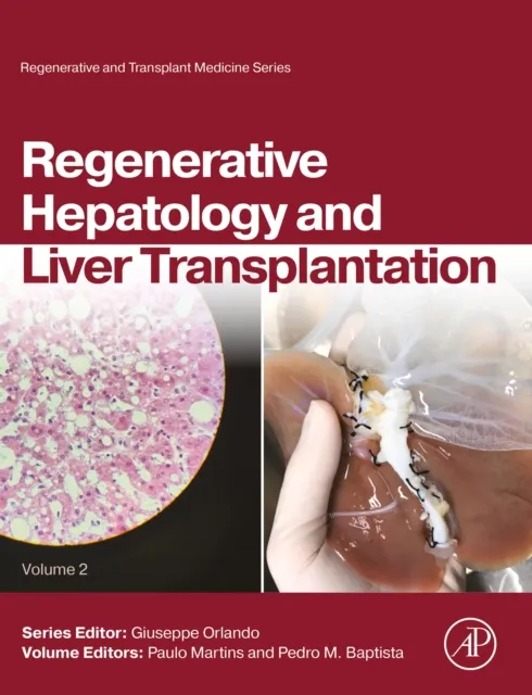 Regenerative Hepatology and Liver Transplantation
