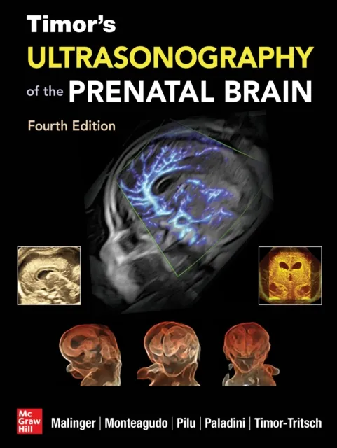 Timor's Ultrasonography of the Prenatal Brain, Fourth Edition
