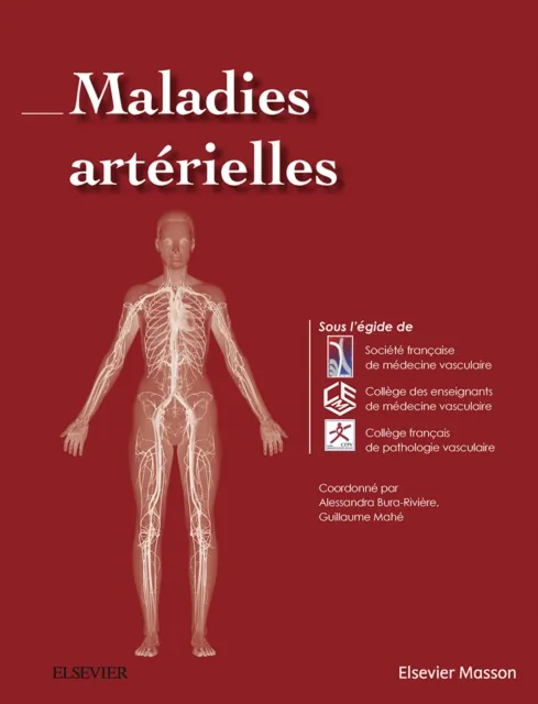Maladies arterielles