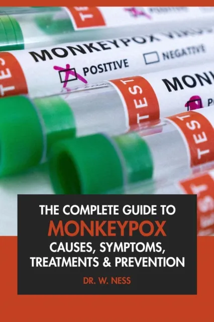 Complete Guide to Monkeypox: Causes, Symptoms, Treatment & Prevention.
