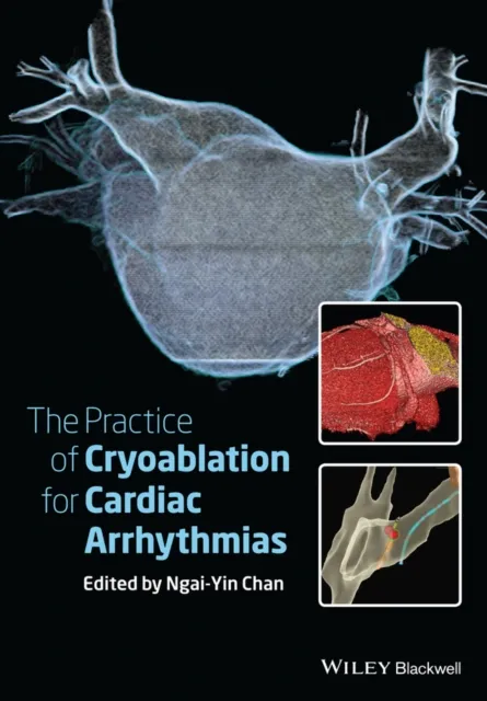 Practice of Catheter Cryoablation for Cardiac Arrhythmias