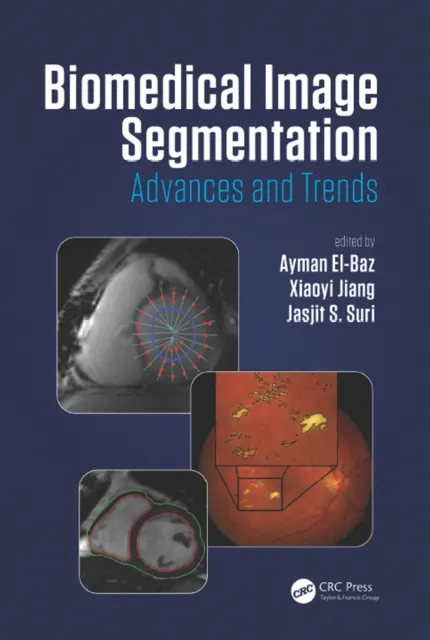 Biomedical Image Segmentation