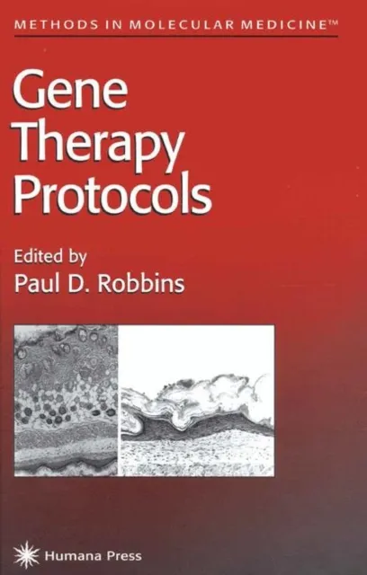 Gene Therapy Protocols
