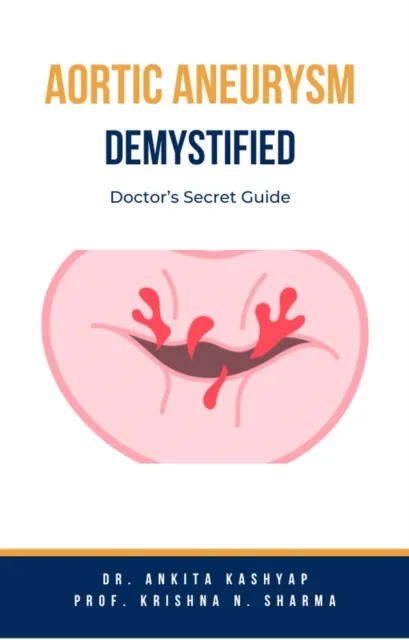 Aortic Aneurysm Demystified: Doctor's Secret Guide