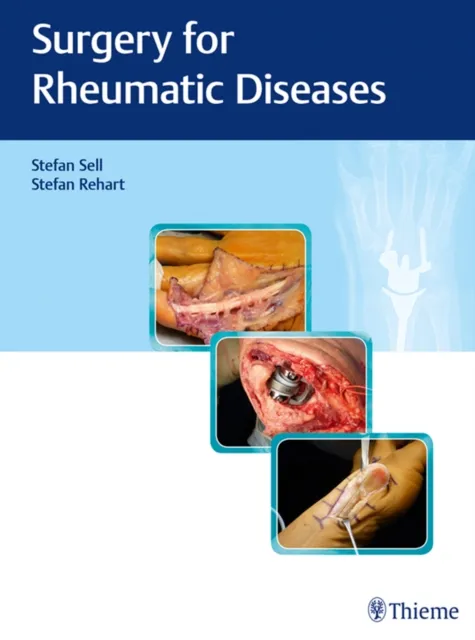Surgery for Rheumatic Diseases