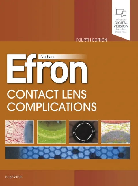 Contact Lens Complications E-Book