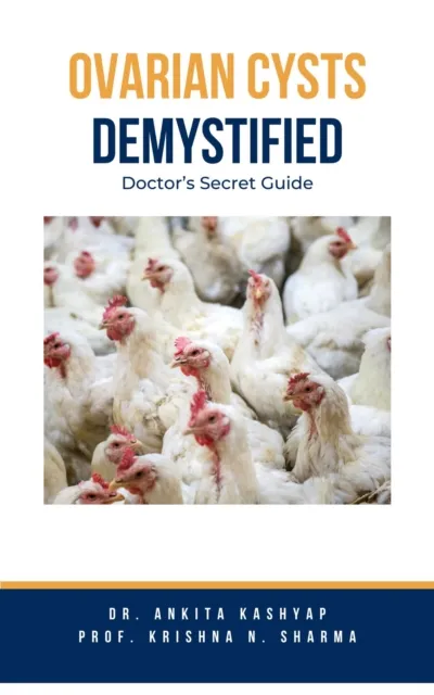 Ovarian Cysts Demystified: Doctor's Secret Guide