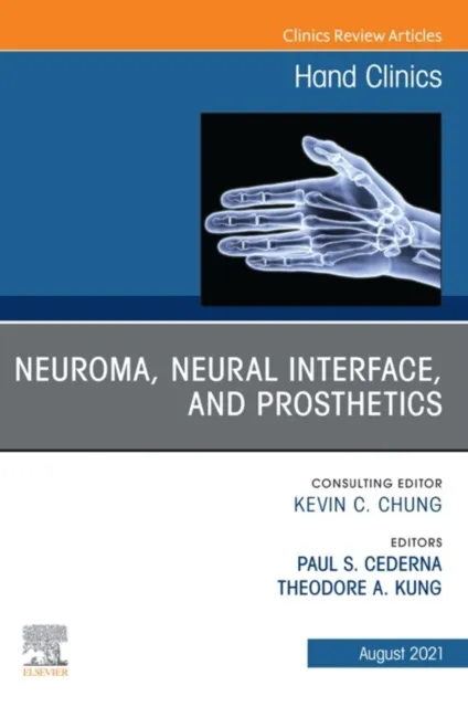 Neuroma, Neural interface, and Prosthetics, An Issue of Hand Clinics, E-Book
