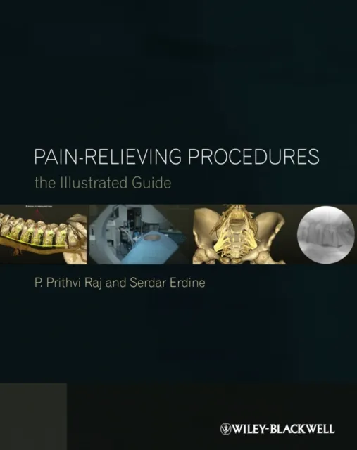 Pain-Relieving Procedures