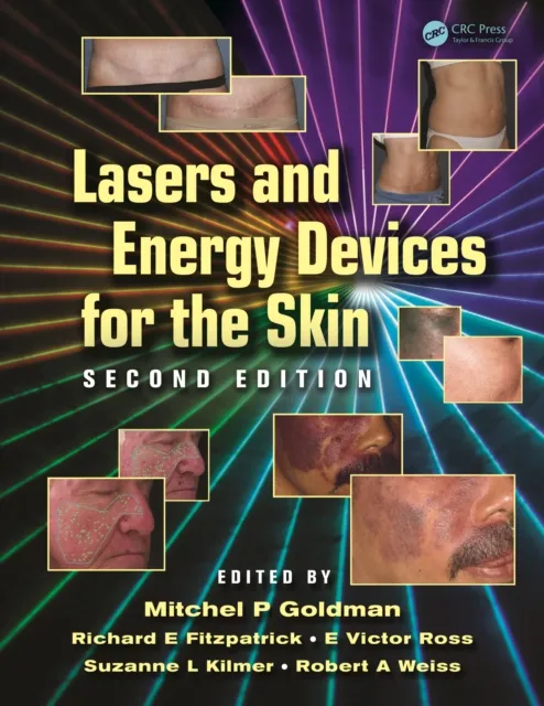 Lasers and Energy Devices for the Skin