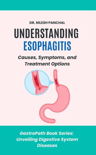 Understanding Esophagitis: Causes, Symptoms, and Treatment Options