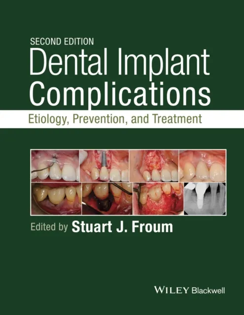 Dental Implant Complications