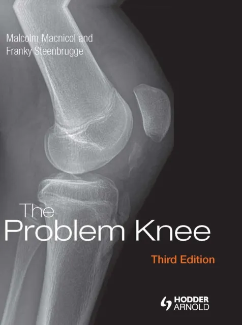 Problem Knee