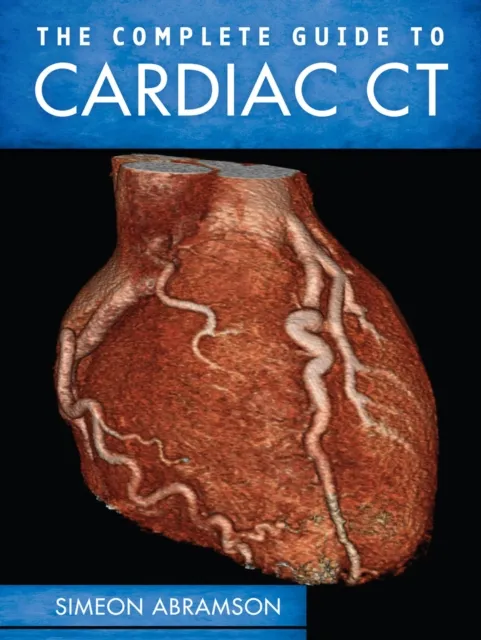 Complete Guide To Cardiac CT (PB)