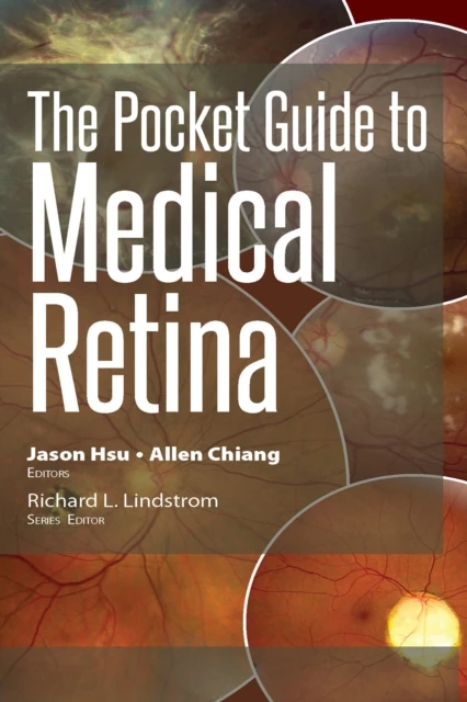 Pocket Guide to Medical Retina