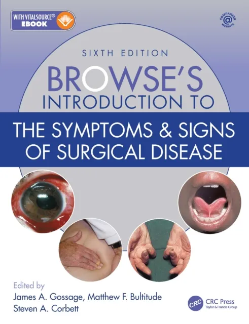 Browse's Introduction to the Symptoms & Signs of Surgical Disease