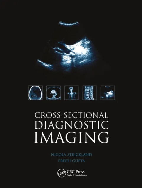 Cross-sectional Diagnostic Imaging