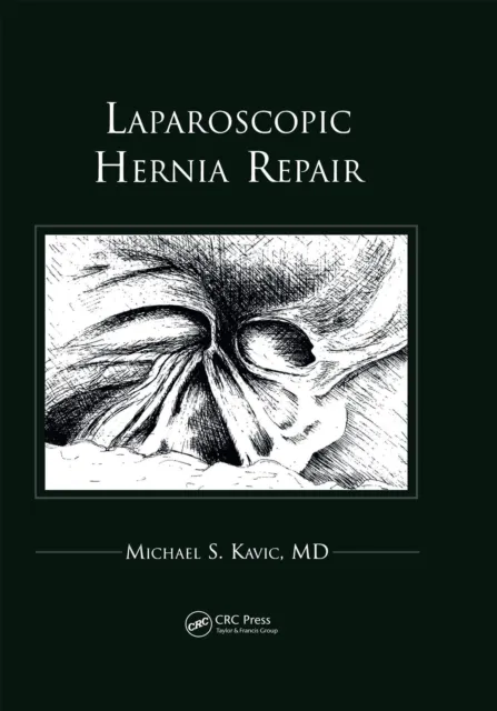 Laparoscopic Hernia Repair