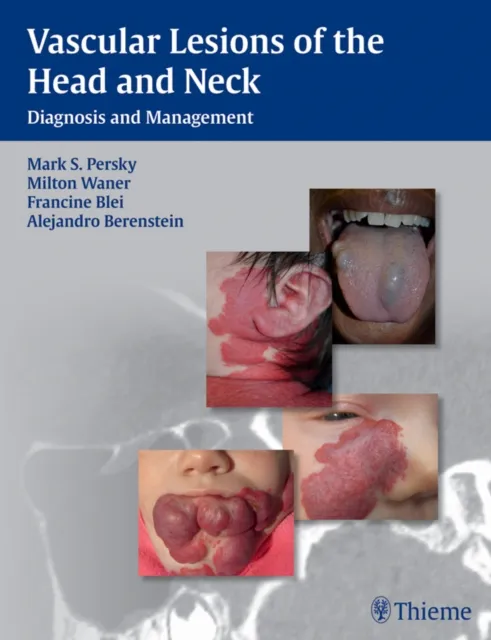 Vascular Lesions of the Head and Neck