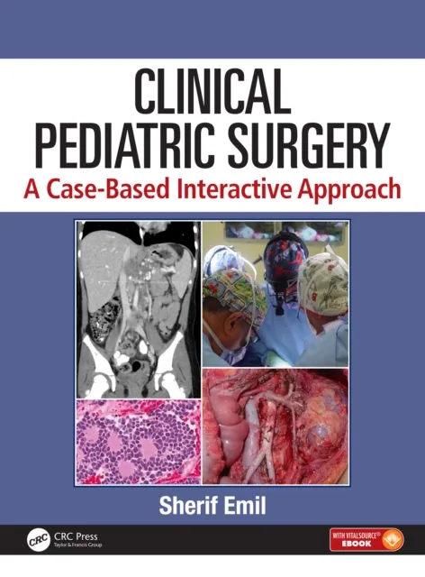 Clinical Pediatric Surgery: A Case-Based Interactive Approach. Mirella & Lino Saputo Foundation edition