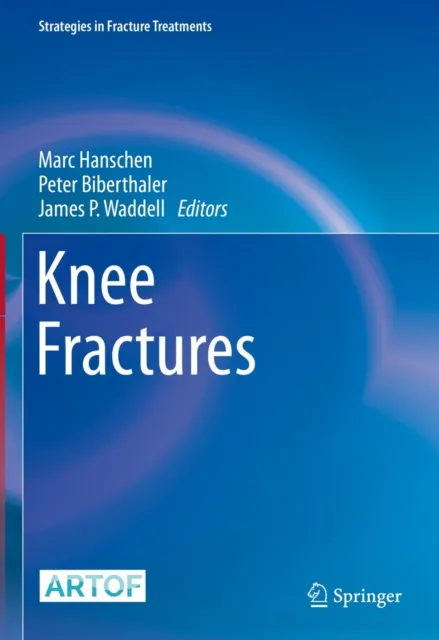 Knee Fractures