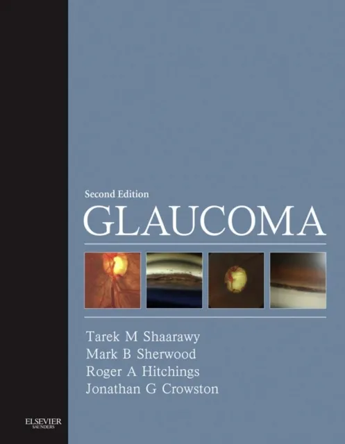 Glaucoma E-Book
