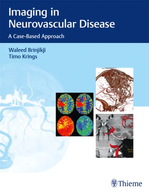 Imaging in Neurovascular Disease
