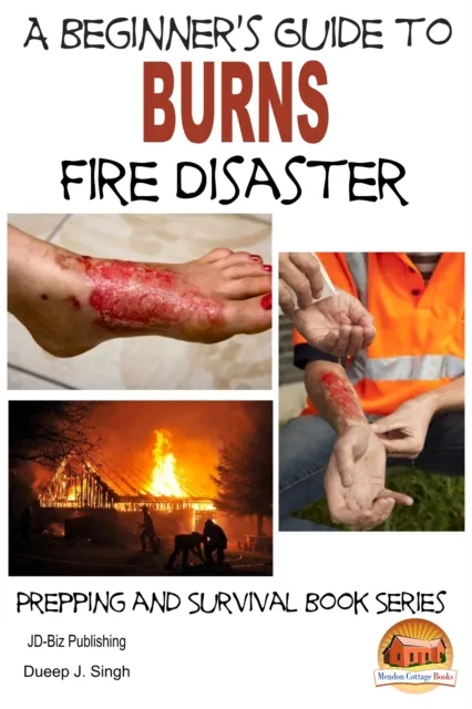 Beginner's Guide to Burns: Fire Disaster