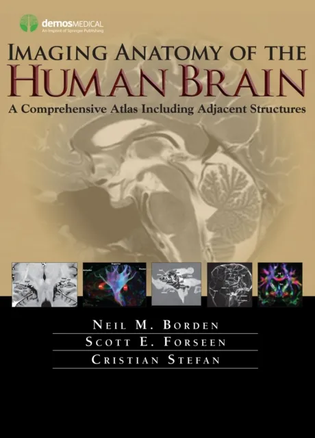 Imaging Anatomy of the Human Brain