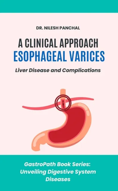 Clinical Approach to Esophageal Varices: Liver Disease and Complications