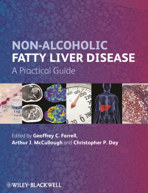 Non-Alcoholic Fatty Liver Disease