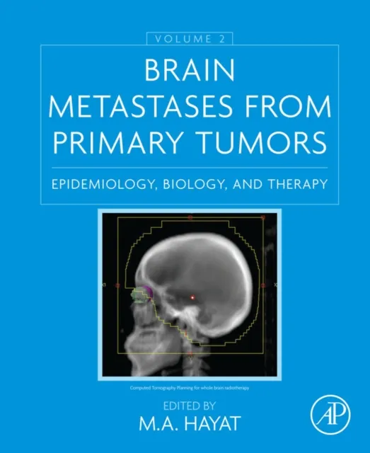Brain Metastases from Primary Tumors, Volume 2