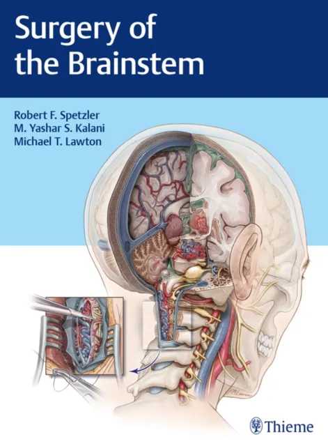 Surgery of the Brainstem