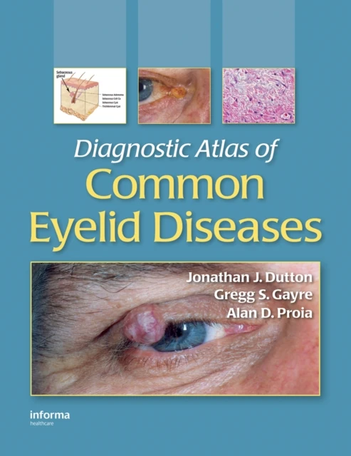 Diagnostic Atlas of Common Eyelid Diseases