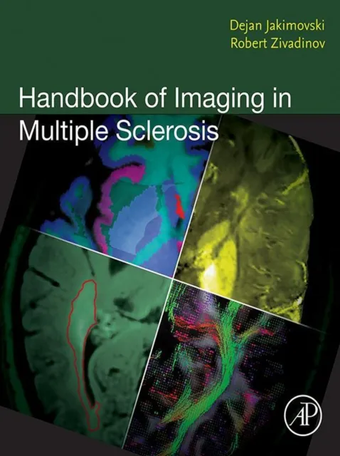 Handbook of Imaging in Multiple Sclerosis