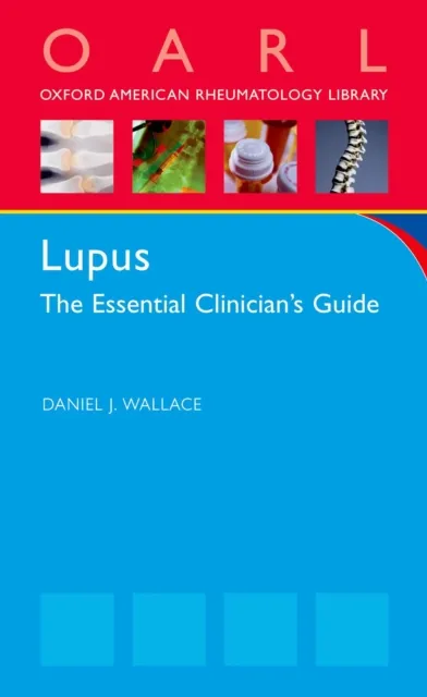 Lupus