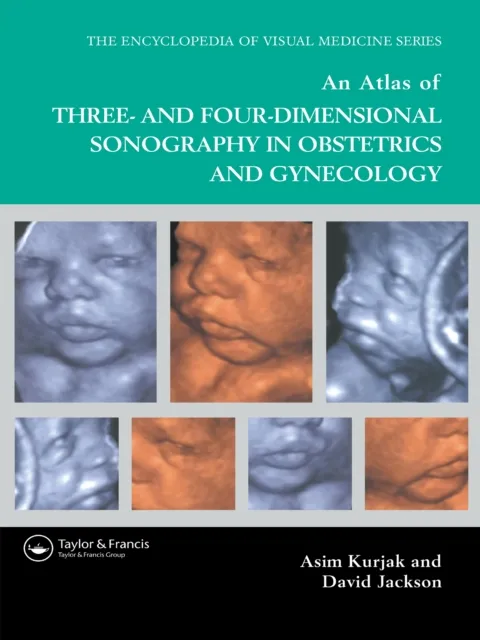 Atlas of Three- and Four-Dimensional Sonography in Obstetrics and Gynecology