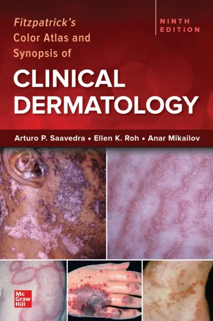 Fitzpatrick's Color Atlas and Synopsis of Clinical Dermatology, Ninth Edition