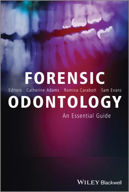 Forensic Odontology