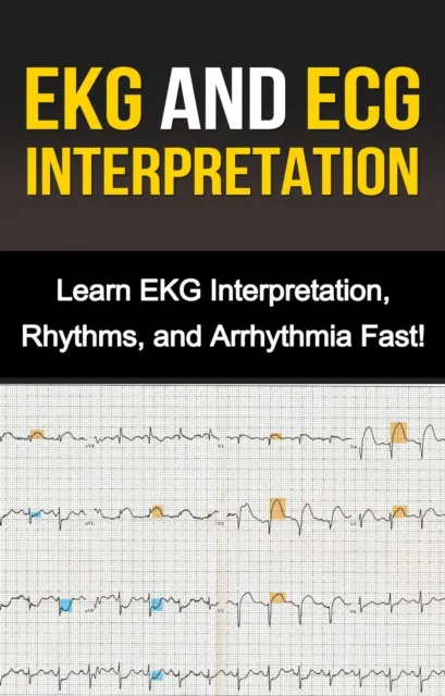 EKG and ECG Interpretation